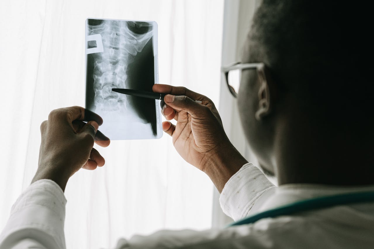 Close-up of a doctor examining a spine X-ray film with a pen in a hospital setting.